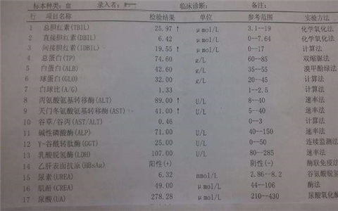 肝功检测能测出乙肝吗