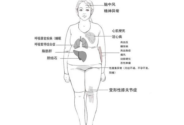 导致肥胖的原因都有哪些？中医这样分析