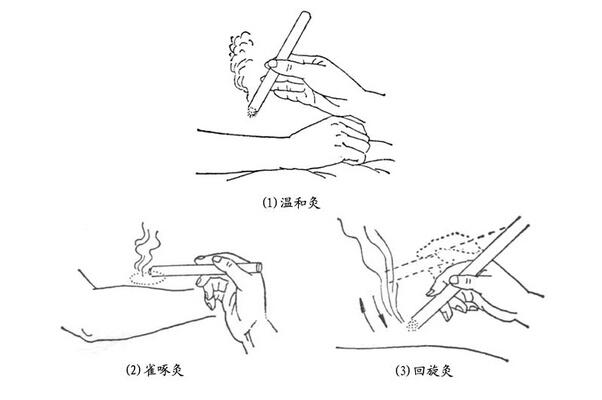 艾灸如何治愈妇科病？这些方法真实有效