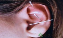 针灸治疗耳聋的作用机理