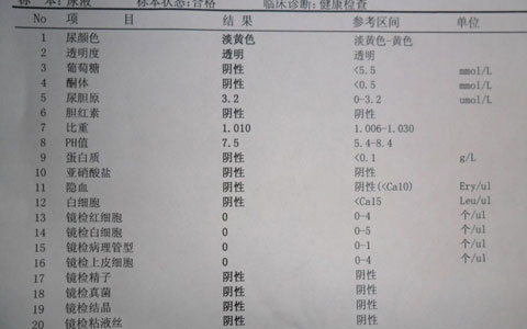 尿常规检查注意事项