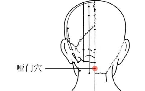 哑门穴在什么地方