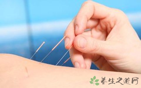 失眠艾炙什么穴位