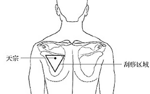 天宗穴在哪里_天宗穴的准确位置图