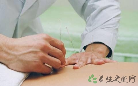 针灸治疗早泄用什么穴位