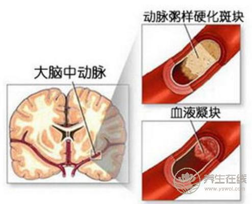 在枕头放这个东西，居然好处这么多！