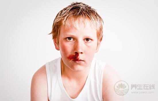 儿子经常流鼻血，小孩流鼻血是什么原因？