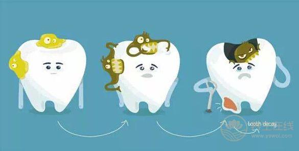 孩子乳牙蛀了怎么回事,乳牙龋齿形成的原因