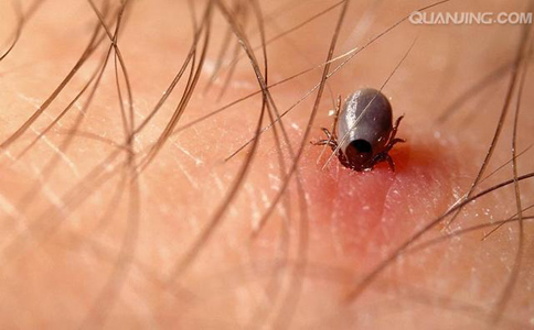 蜱虫的危害有哪些？
