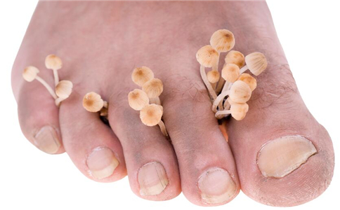 引起脚臭的六大原因 中医哪些方法能去脚臭