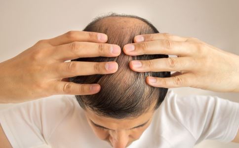脱发问题日益严重 如何才能远离头秃？