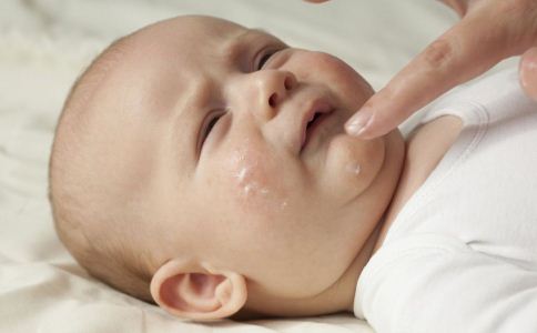 宝宝湿疹如何护理 宝宝湿疹的原因 宝宝湿疹如何护理
