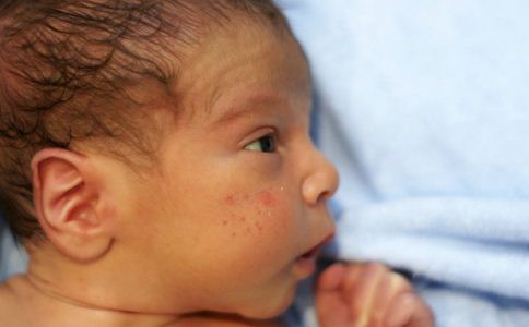 气候干燥为何宝宝得湿疹？如何有效护理
