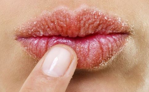 秋季慢性唇炎的症状及治疗方法