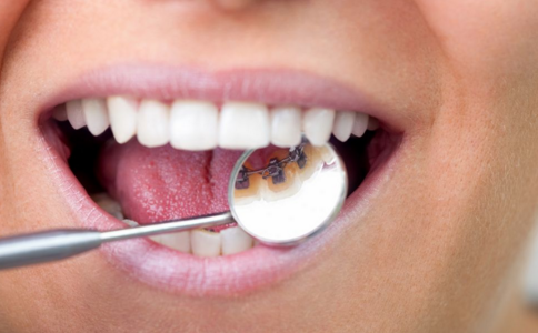 假牙如何护理 假牙的护理方法 假牙护理需要注意什么