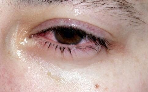 眼睛近视按摩方法 近视眼的按摩方法 治疗近视的最好方法