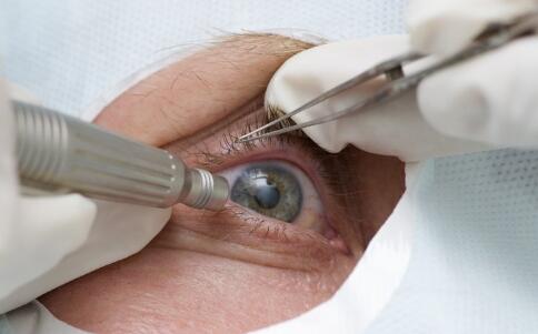 近视手术后如何保养 近视手术后的保养方法有哪些 近视眼手术后要注意什么